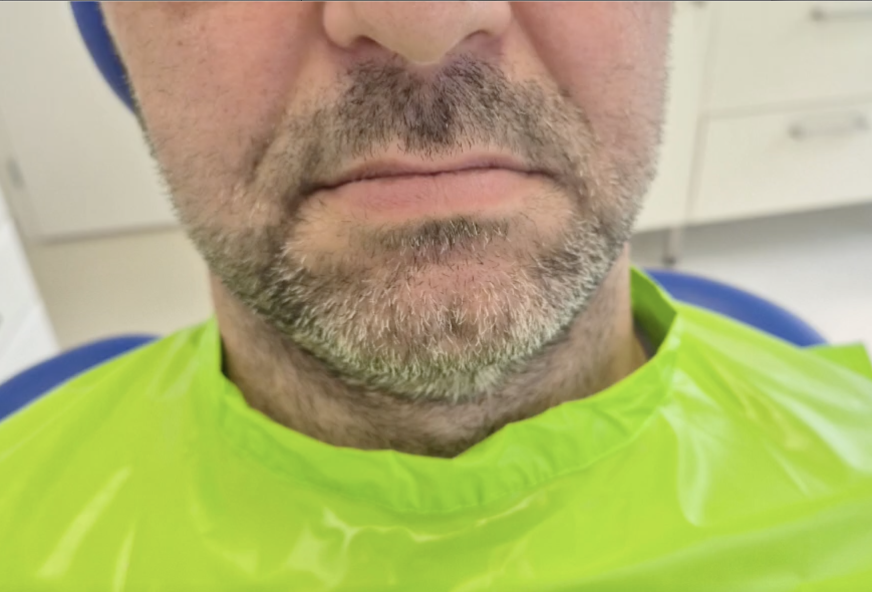 Implantátum